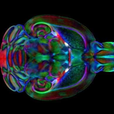 This shows the mouse brain.