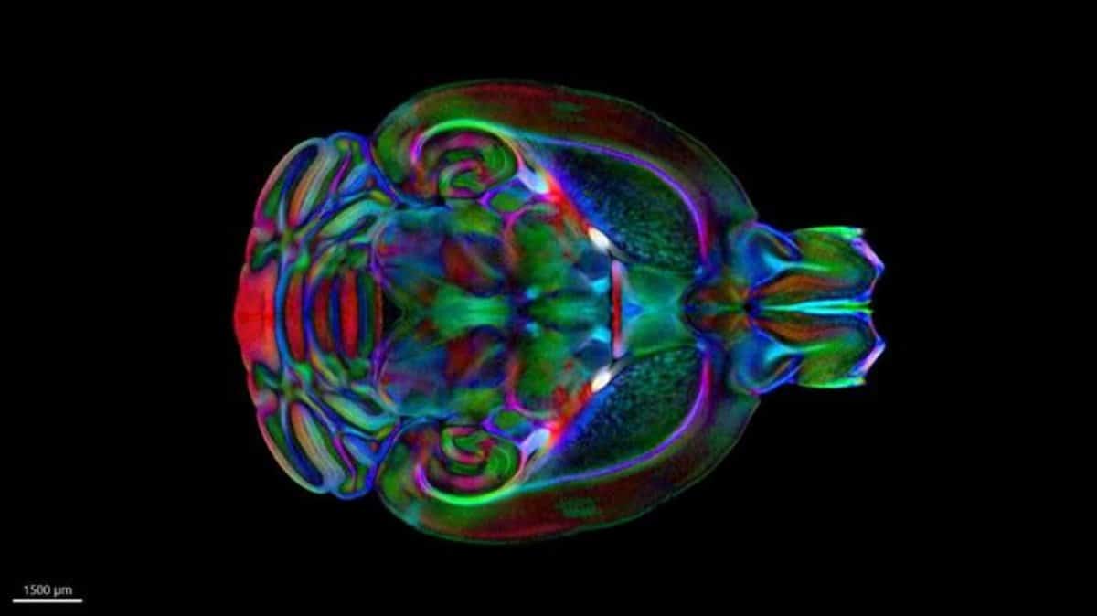 This shows the mouse brain.