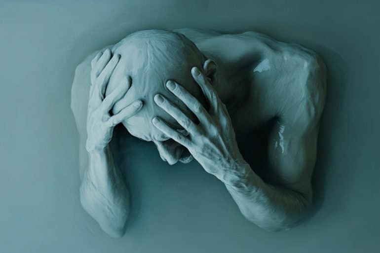 This shows a person holding their head.