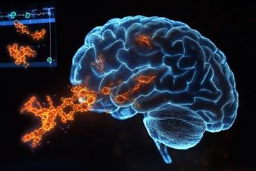 This shows a brain.