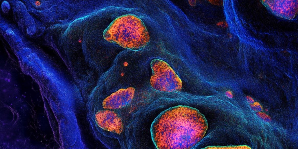 This shows cells.