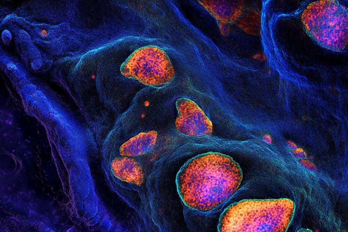 This shows cells.