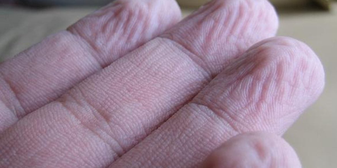 This shows wrinkled fingers.