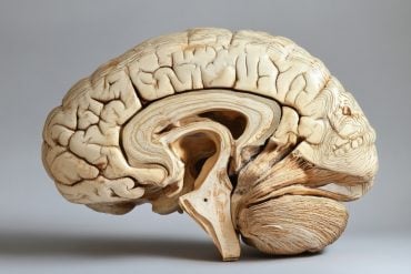 This shows a brain.