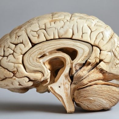 This shows a brain.