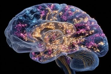 This shows a brain.