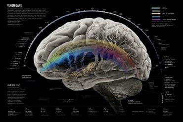 This shows a brain.