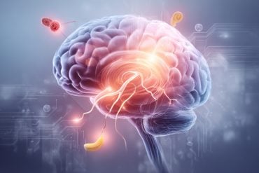 This shows a brain.