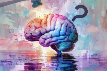 This shows a brain.