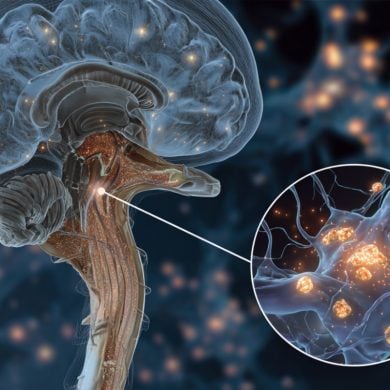 This shows a brain.