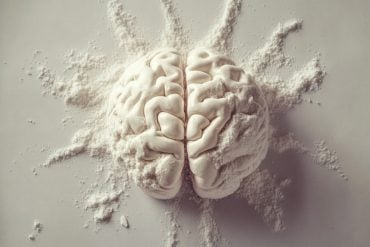 This shows a brain.