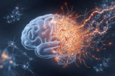This shows a brain.