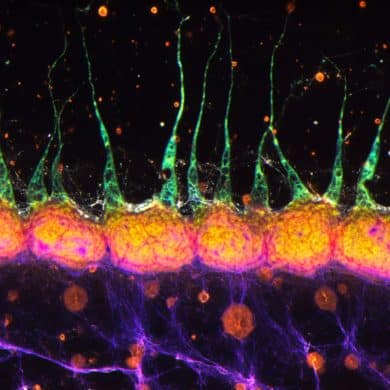 This shows AI representations of neurons.