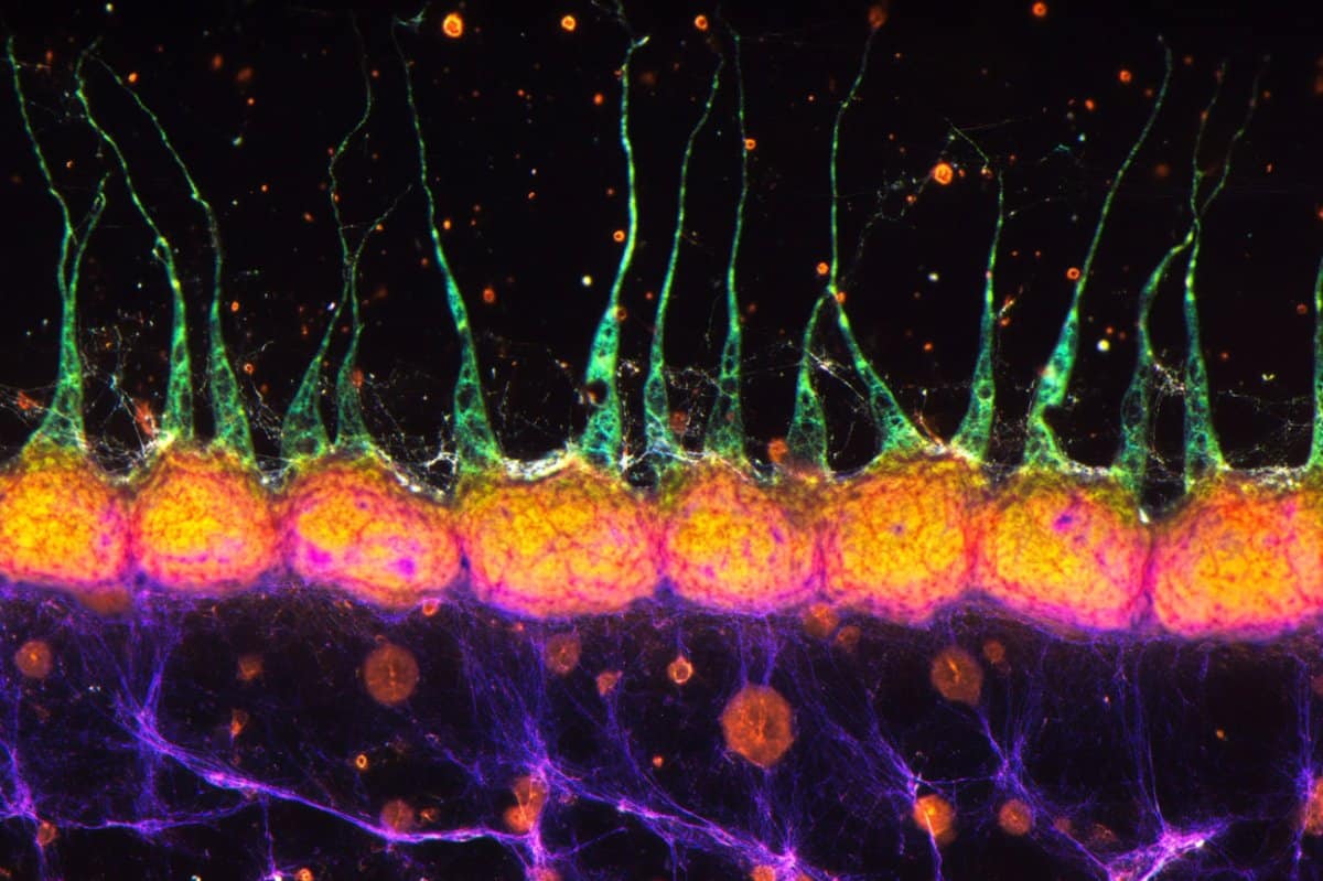 This shows AI representations of neurons.