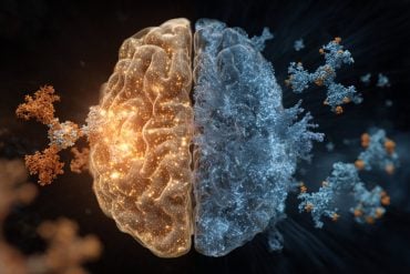 This shows a brain.