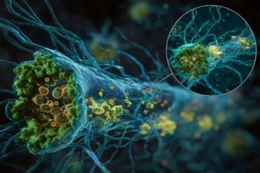 This shows a neuron.