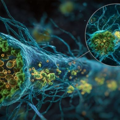 This shows a neuron.
