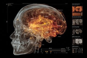 This shows a skull and a brain.