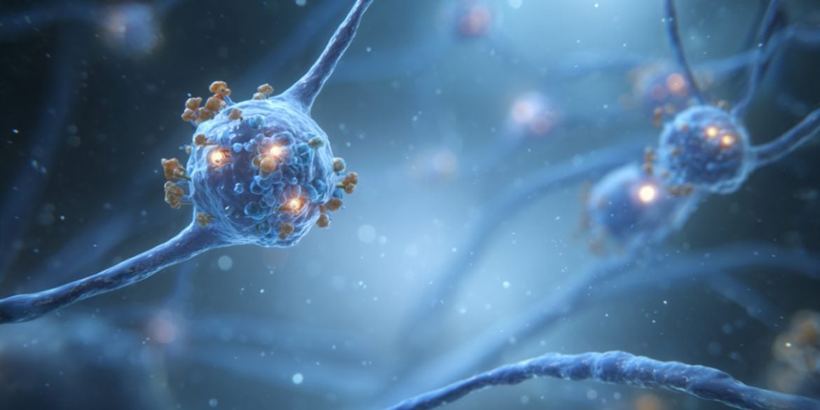 This shows a neuron.