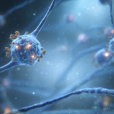 This shows a neuron.