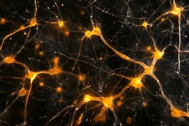 This shows synapses.