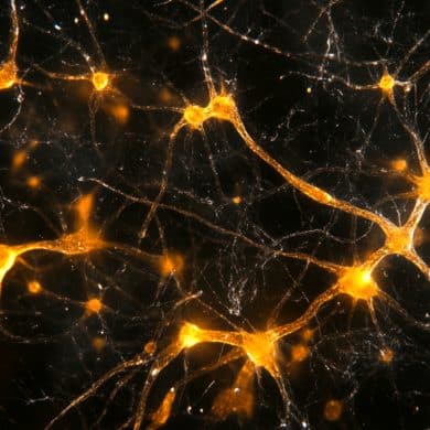 This shows synapses.