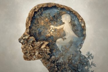 This shows a woman's head and a brain.