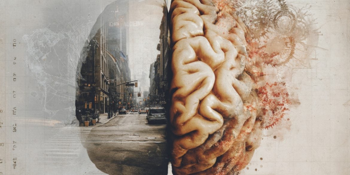 This shows a brain.