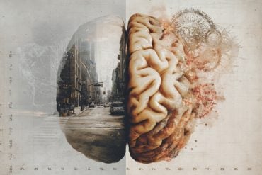 This shows a brain.