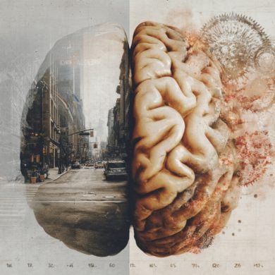 This shows a brain.