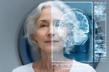 This shows a woman and a brain scan.