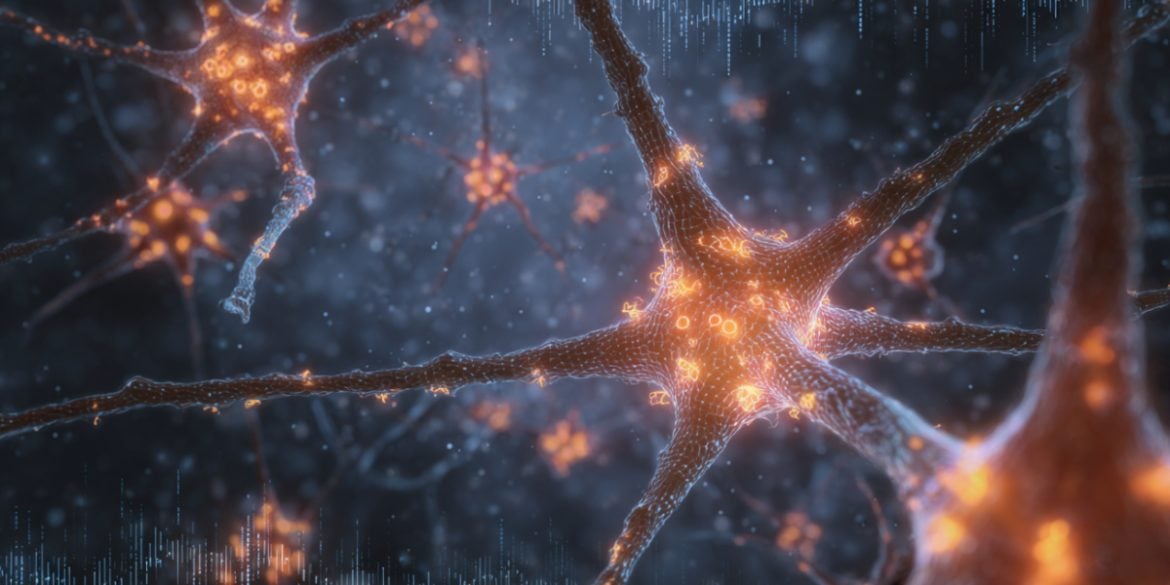 This shows astrocytes.