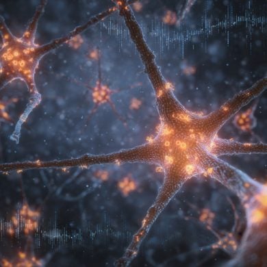 This shows astrocytes.