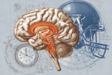 This shows a brain and a football helmet.