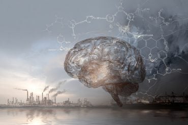 This shows a brain.