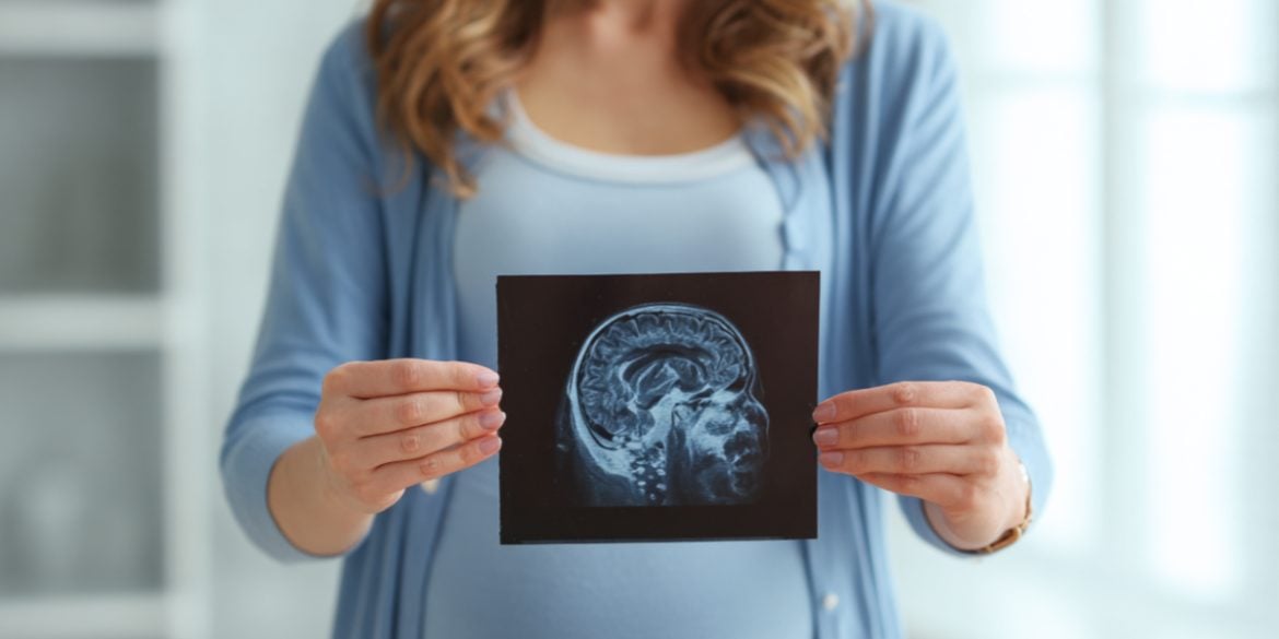 This shows a pregnant woman and a brain scan.
