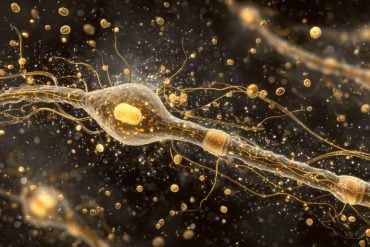This shows a neuron.