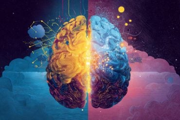 This shows a brain.