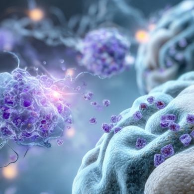 This shows microglia and a brain.
