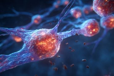 This shows microglia