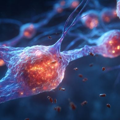 This shows microglia