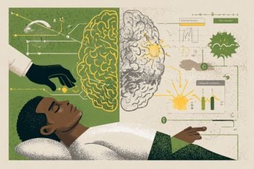 This shows a brain with a man undergoing a medical procedure below it.
