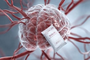 This shows a brain and a packet of sweetener.