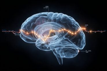 This shows a brain.