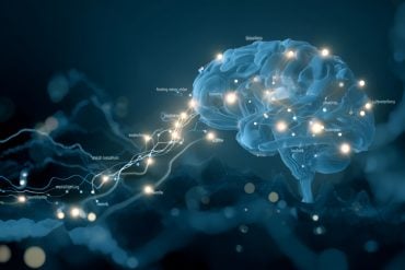 This shows a brain.