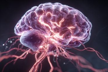 This shows a brain and blood vessels.