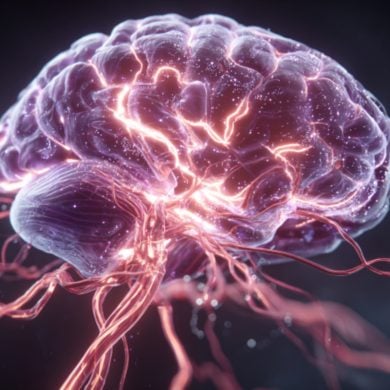 This shows a brain and blood vessels.