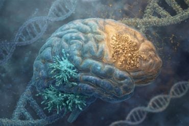 This shows a brain surrounded by DNA.