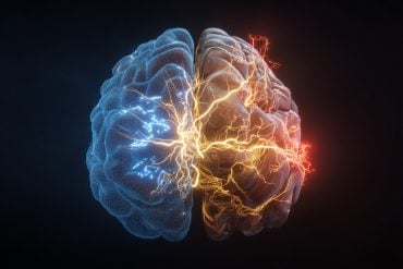 This shows a brain.