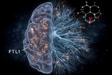 This shows a brain.